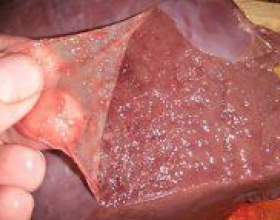 �� ����� ����� � �������? фото