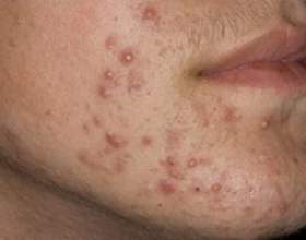 �� ��������� ���� ����: ������ � ��������� �������� фото